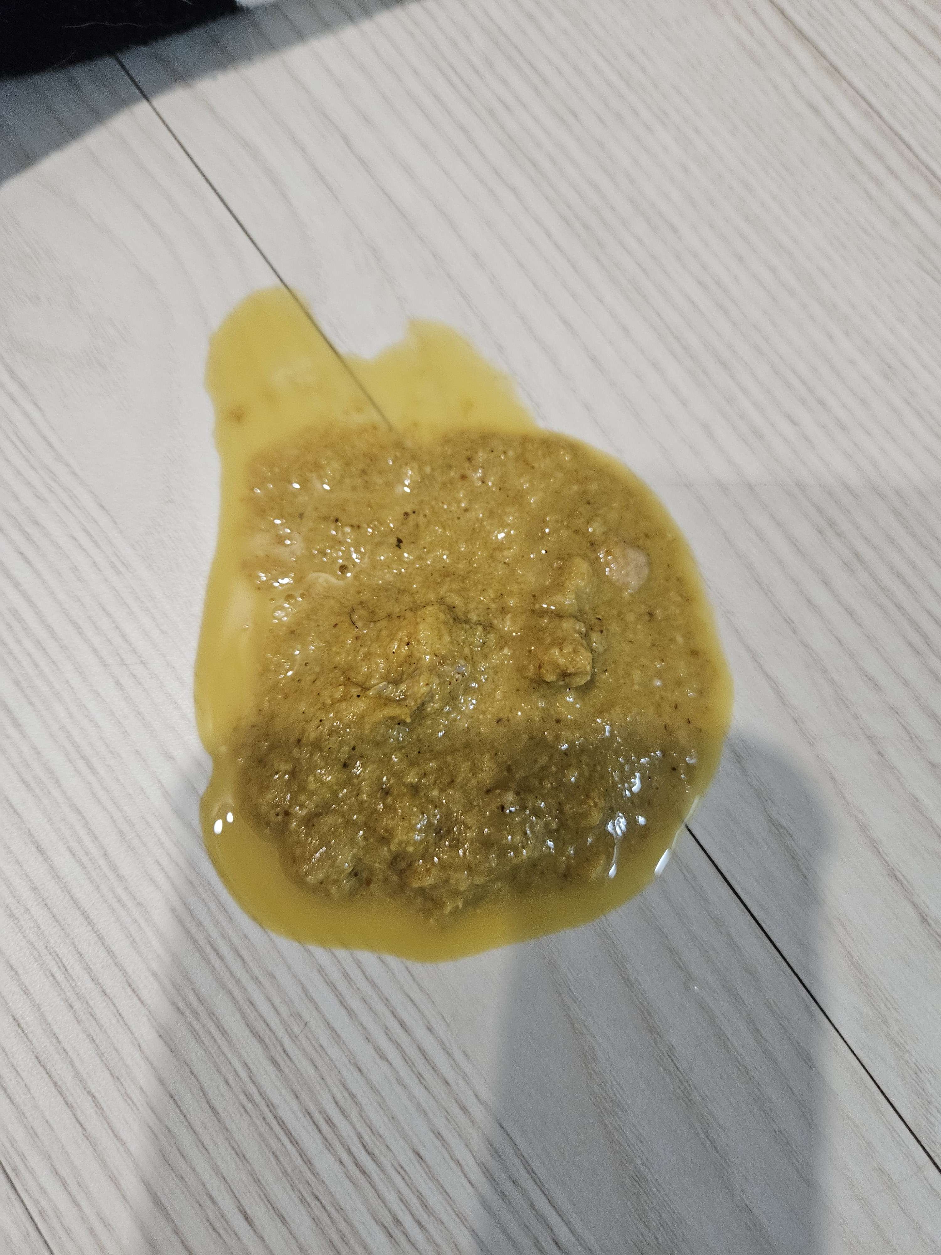 간헐적으로 토를 하는데...왜그럴까요 - 포동 | 커뮤니티